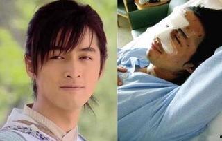 意外受伤的明星,意外伤痛背后的明星故事